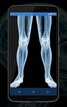 Real X Ray Body Scanner Prank: X Ray App screenshot 6