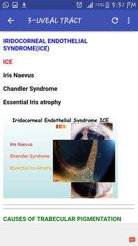 Ophthalmology Mnemonics скриншот 5