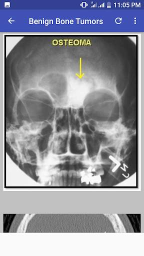 Bone X Ray Interpretation (Musculoskeletal X ray) screenshot 6