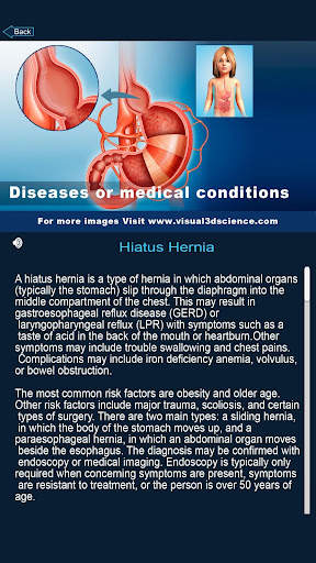 My Stomach Anatomy screenshot 5