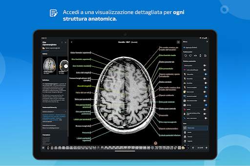 e-Anatomy screenshot 13