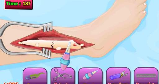 Doktor Tom Beinoperation Spiel screenshot 10