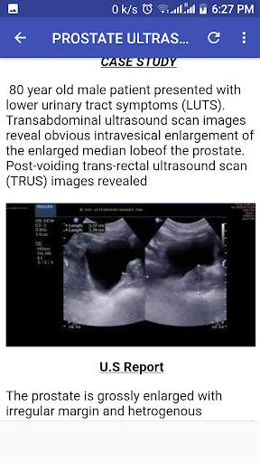 Ultrasound Guide A2Z 10 تصوير الشاشة