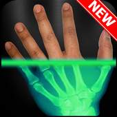 XRay Scanner Camera Prank 1.1