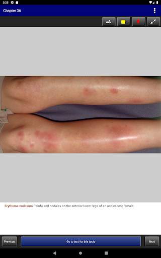 Pediatric Dermatology DDx Deck, 2nd Edition screenshot 22