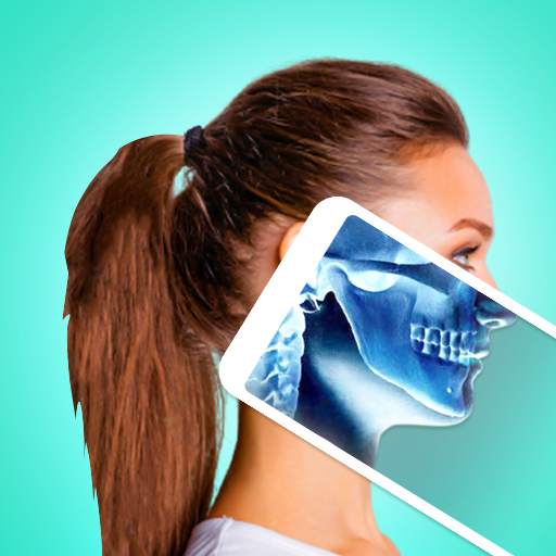 Xray App – X RAY Scanner Guide 1.4