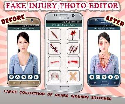 Injury Photo Editor 2 تصوير الشاشة