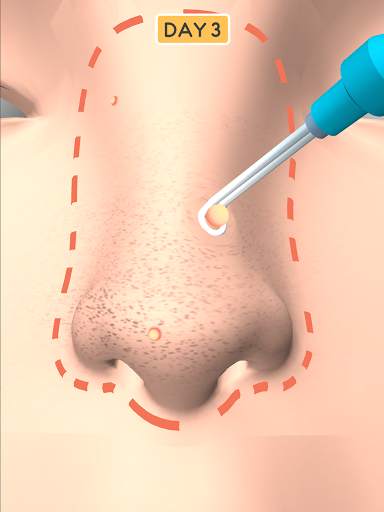 Nose Clean screenshot 13