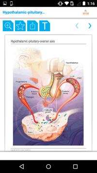 Mini Atlas Gynaecology screenshot 3