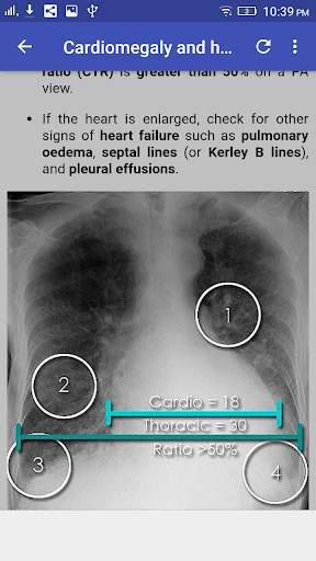 Chest X-Ray Interpretation screenshot 8