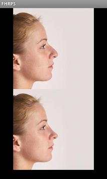 Plastic Surgery w/ Dr. Vitenas screenshot 5