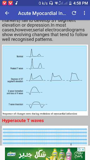 Clinical ECG Guide. screenshot 7