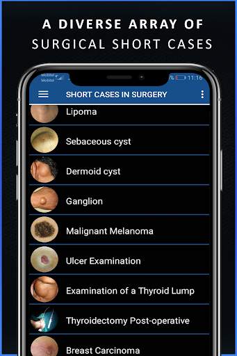 Short Cases in Surgery - OSCE for Medical Doctors screenshot 3