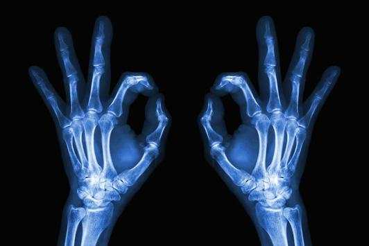 X-Ray Cloth Scanner Prank screenshot 3