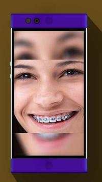 Real Braces Booth HD Studio screenshot 3