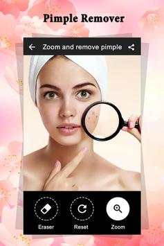 Pimple Remover : Beauty Plus screenshot 4