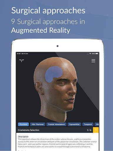 UpSurgeOn Neurosurgery screenshot 7