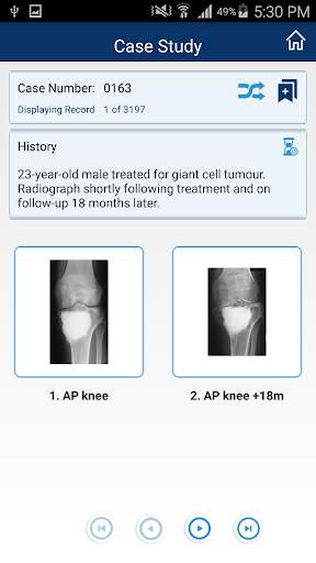 MSK RADIOLOGY 4 U screenshot 5