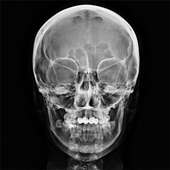 xray on 9Apps