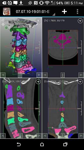DroidRender - 3D DICOM viewer स्क्रीनशॉट 7