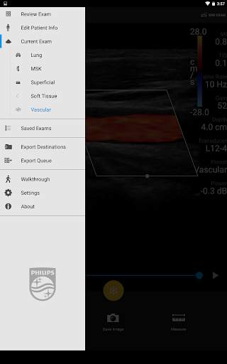 Philips Lumify Ultrasound App screenshot 4