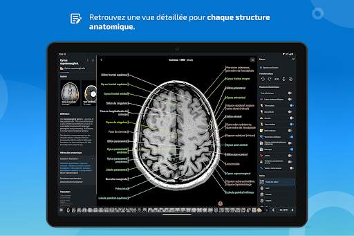 e-Anatomy screenshot 13