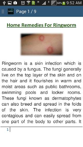 Ringworm Home Remedies screenshot 2