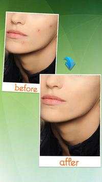 Remove Unwanted Object : Removal element in photo screenshot 3