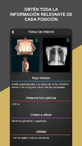 RX - Posiciones Radiológicas screenshot 4