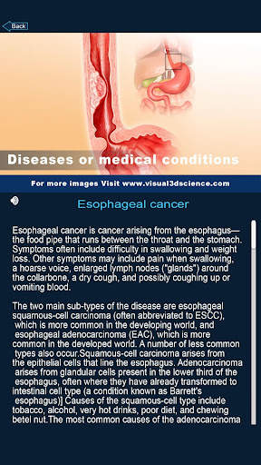 My Stomach Anatomy screenshot 7