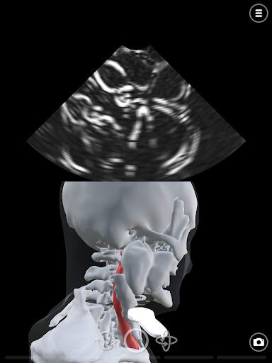 Deepscope Ultrasound Simulator screenshot 12