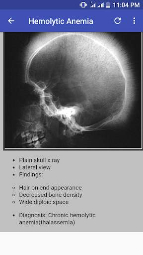 Bone X Ray Interpretation (Musculoskeletal X ray) screenshot 3