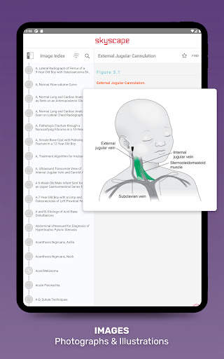 Harriet Lane Handbook App screenshot 19