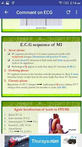 A to Z ECG Interpretation screenshot 5