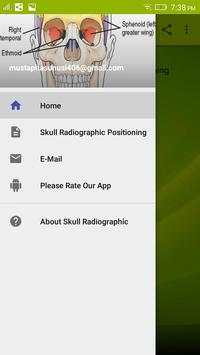 Skull Radiographic Positioning screenshot 2