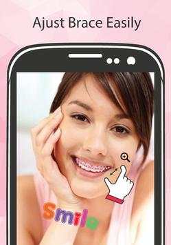 Brace Selfie Beauty Photo edit screenshot 2