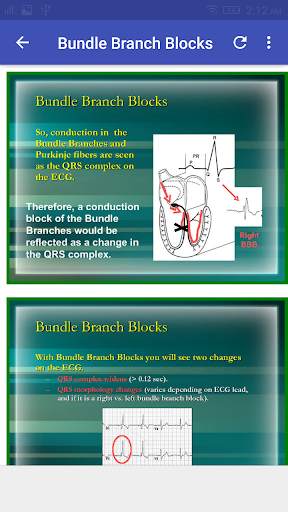 A to Z ECG Interpretation screenshot 7