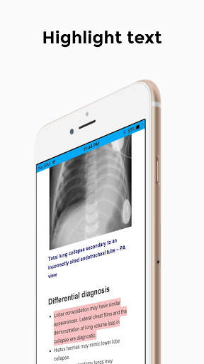CXR FlashCards - Reference app for Chest X-rays screenshot 3