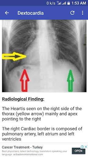 X-Ray Interpretation Guide screenshot 6