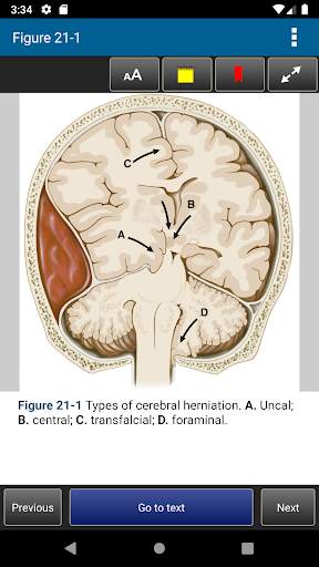 Harrison's Manual of Medicine 20th Edition screenshot 6