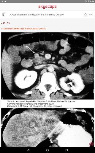 CURRENT Medical Diagnosis and Treatment screenshot 17