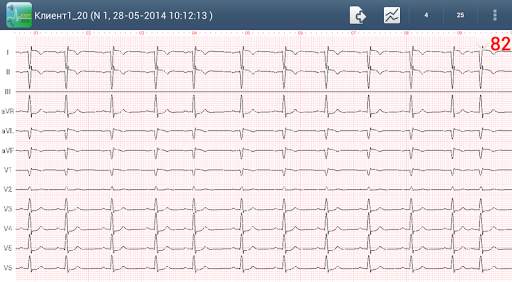 Easy ECG Mobile PRO screenshot 2