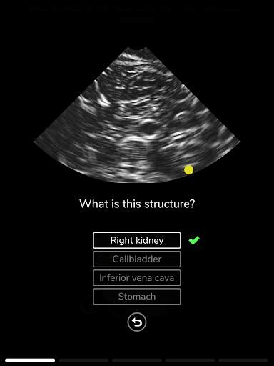 Deepscope Ultrasound Simulator screenshot 11