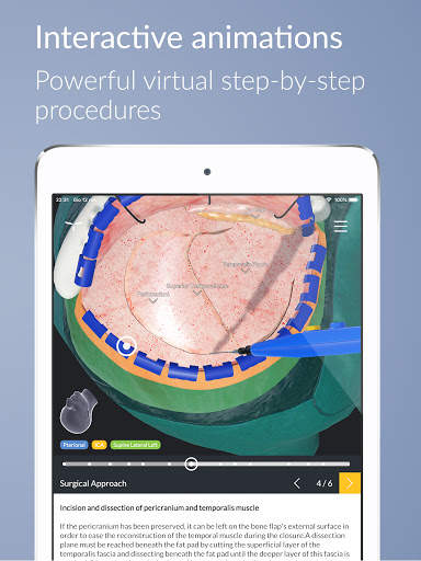 UpSurgeOn Neurosurgery screenshot 10