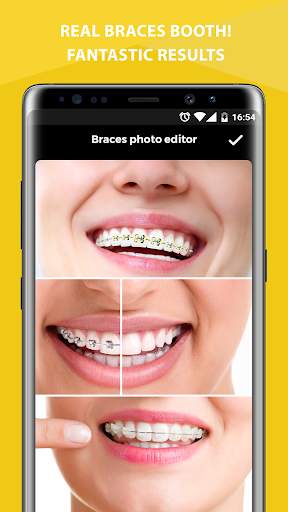 Braces Photo Editor screenshot 3