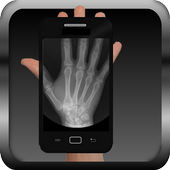 Scanner Xray Prank icon