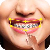 Braces Pro 1.3.v7a