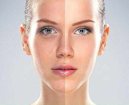 Acne Remover Photo Editor screenshot 3