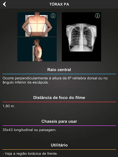 RX - Radiologia Posicionamento screenshot 8