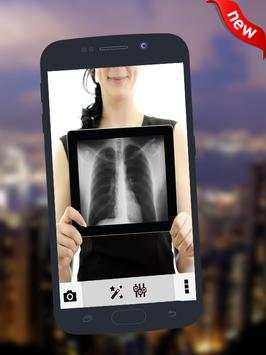 Sexy X-ray Girls Scanner Prank screenshot 2